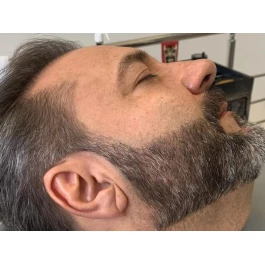 Full Barba (Micropigmentação de Barba) Full Barba (Micropigmentação de Barba)
