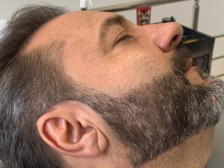 Full Barba (Micropigmentação de Barba)